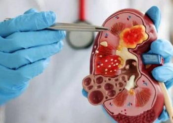 Ciri-ciri Ginjal Sehat dan Tanda-tanda Kerusakan Ginjal Menurut Dokter